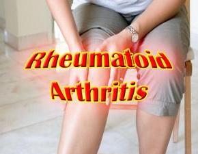 Healthline.com: Is Xeljanz a Blessing or a Curse for Rheum&nbsp;Patients?