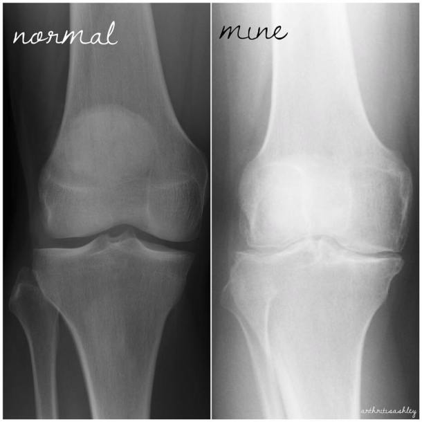 21432984_1872437322772885_4156674972513327609_n