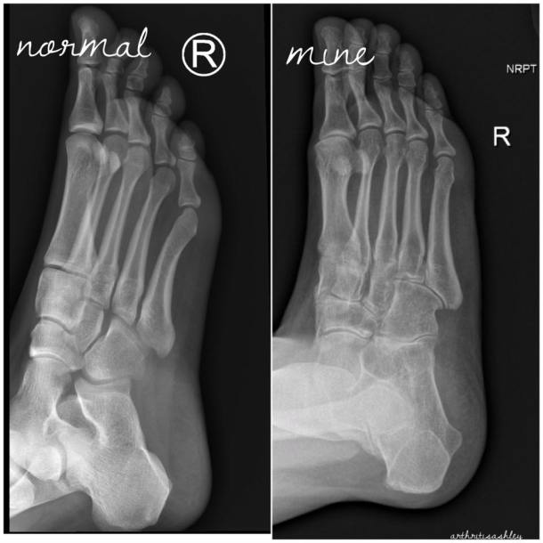 21558615_1872437382772879_5938197761275147929_n