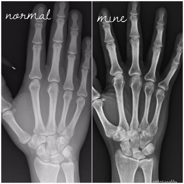 21558713_1872437356106215_2084070653424307359_n